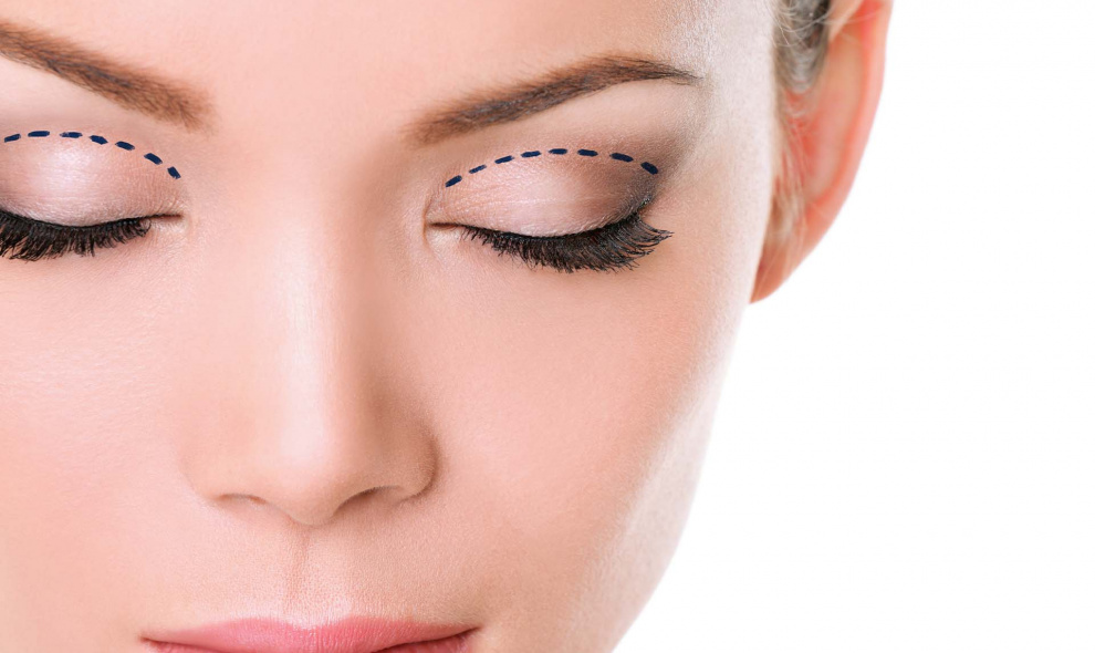 Plastická operace horních očních víček